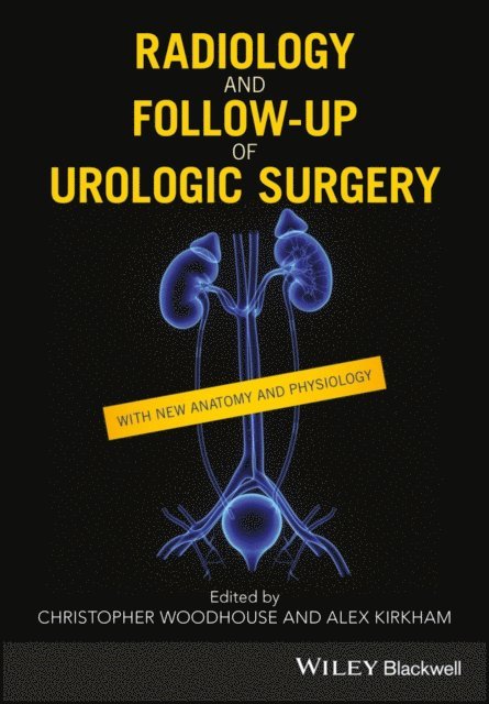 Alex Kirkham, Christopher R. J. Woodhouse - Radiology and Follow-up of Urologic Surgery, E-bok. Tillgänglighet: Lägg i varukorg