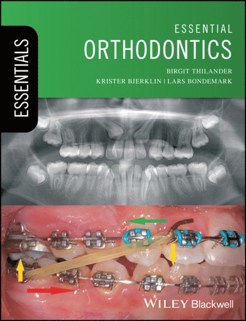 Lars Bondemark, Krister Bjerklin, Birgit Thilander - Essential Orthodontics, E-bok