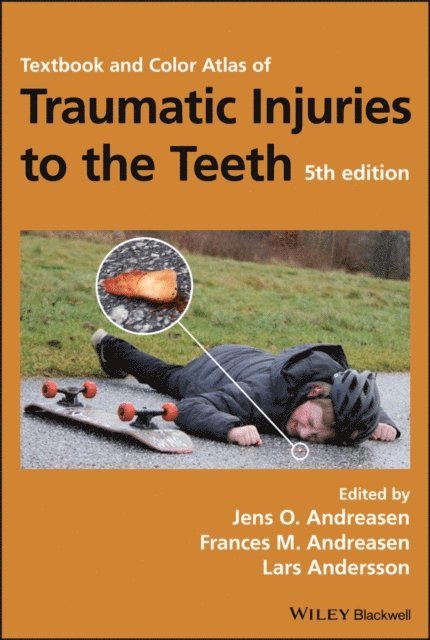 Lars Andersson, Frances M. Andreasen, Jens O. Andreasen - Textbook and Color Atlas of Traumatic Injuries to the Teeth, E-bok