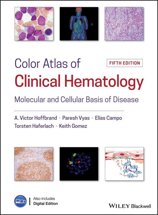A. Victor Hoffbrand, Paresh Vyas, Elias Campo, Torsten Haferlach, Keith Gomez - Color Atlas of Clinical Hematology: Molecular and Cellular Basis of Disease. Tillgänglighet: Tillfälligt slut