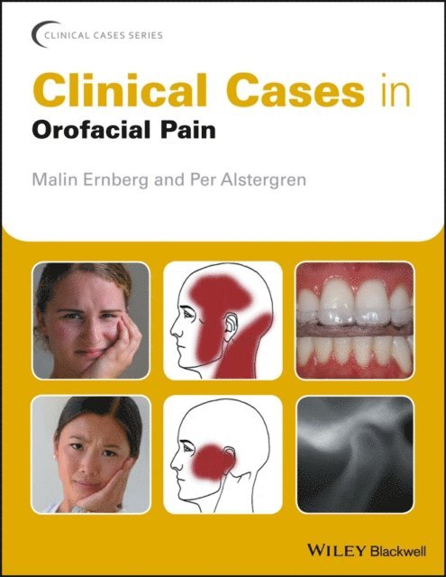 Per Alstergren, Malin Ernberg - Clinical Cases in Orofacial Pain, E-bok