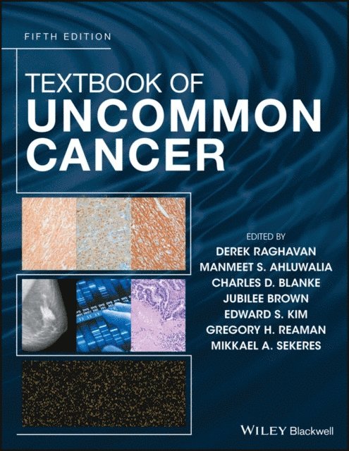 Mikkael A. Sekeres, Gregory H. Reaman, Edward S. Kim, Jubilee Brown, Charles D. Blanke, Manmeet S. Ahluwalia, Derek Raghavan - Textbook of Uncommon Cancer, E-bok