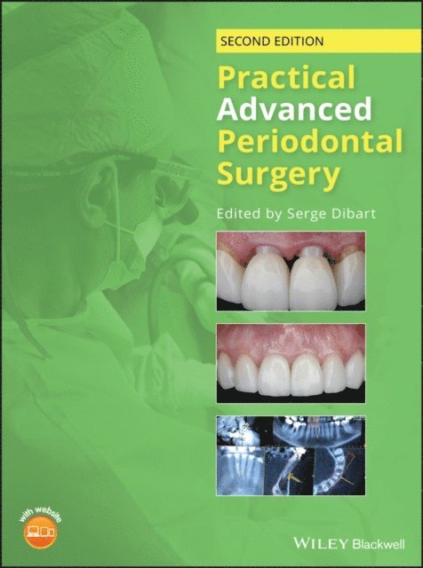 Serge Dibart - Practical Advanced Periodontal Surgery, E-bok