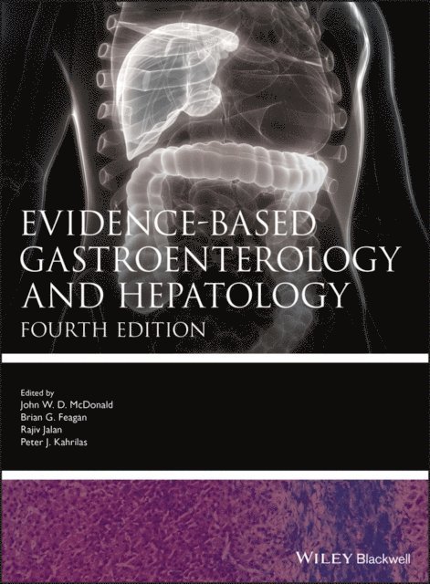 Peter J. Kahrilas, Rajiv Jalan, Brian G. Feagan, John W. D. McDonald - Evidence-based Gastroenterology and Hepatology, E-bok