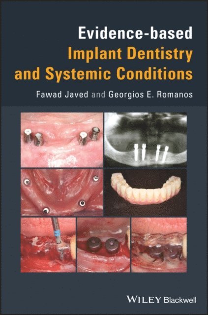 Georgios E. Romanos, Fawad Javed - Evidence-based Implant Dentistry and Systemic Conditions, E-bok