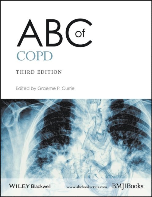 Graeme P. Currie - ABC of COPD, E-bok