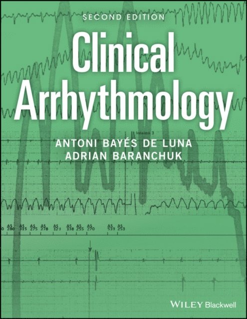 Adrian Baranchuk, Antoni Bay s de Luna - Clinical Arrhythmology, E-bok