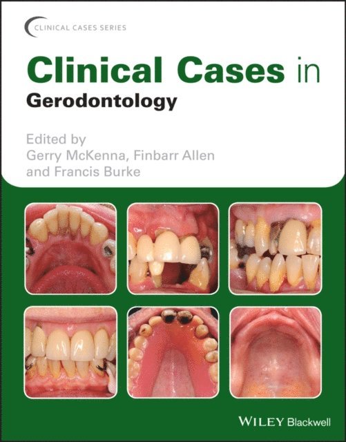 Francis Burke, Finbarr Allen, Gerry McKenna - Clinical Cases in Gerodontology, E-bok
