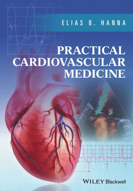 Elias B. Hanna - Practical Cardiovascular Medicine, E-bok