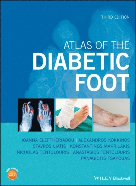 Panagiotis Tsapogas, Anastasios Tentolouris, Nicholas Tentolouris, Konstantinos Makrilakis, Stavros Liatis, Alexandros Kokkinos, Ioanna Eleftheriadou - Atlas of the Diabetic Foot, E-bok