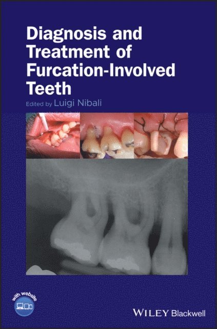 Luigi Nibali - Diagnosis and Treatment of Furcation-Involved Teeth, E-bok