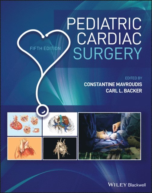 Carl L. Backer, Constantine Mavroudis - Pediatric Cardiac Surgery, E-bok