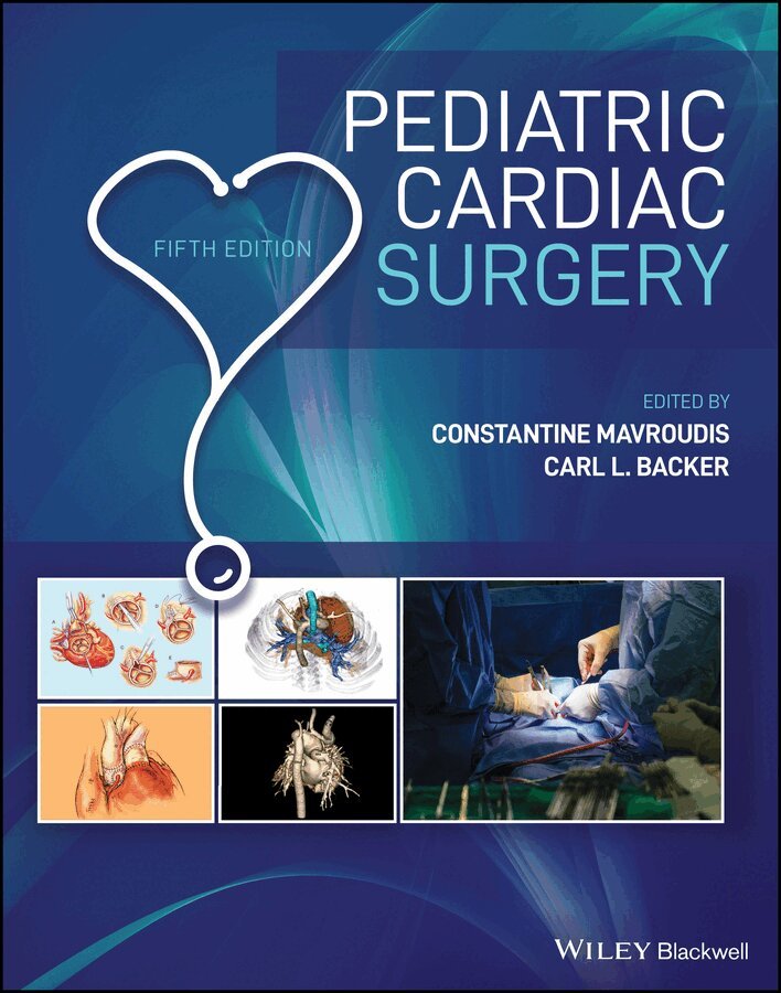 Constantine Mavroudis, Carl L. Backer - Pediatric Cardiac Surgery 5e. Tillgänglighet: Tillfälligt slut