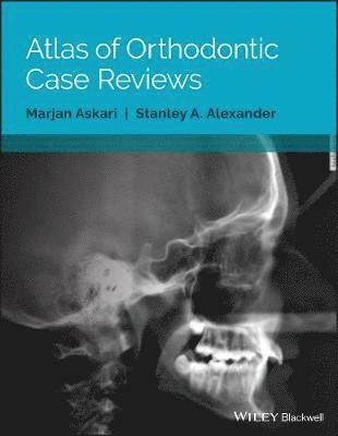 Marjan Askari, Stanley A. Alexander - Atlas of Orthodontic Case Reviews, Häftad
