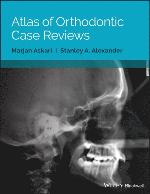 Stanley A. Alexander, Marjan Askari - Atlas of Orthodontic Case Reviews, E-bok