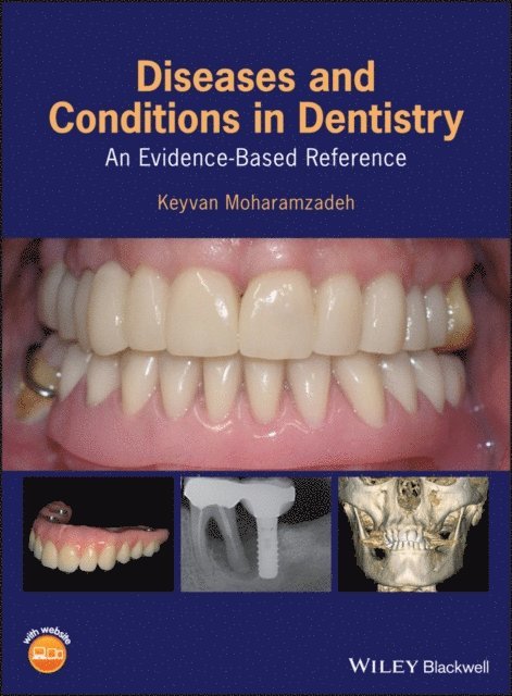 Keyvan Moharamzadeh - Diseases and Conditions in Dentistry, E-bok