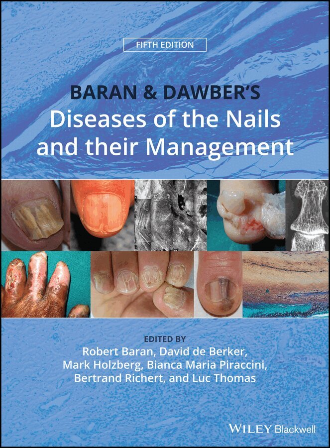 Robert Baran, David A. R. de Berker, Mark Holzberg, Bianca Maria Piraccini, Bertrand Richert, Luc Thomas - Baran & Dawber′s Diseases of the Nails and their Management Fifth Edition. Tillgänglighet: Tillfälligt slut