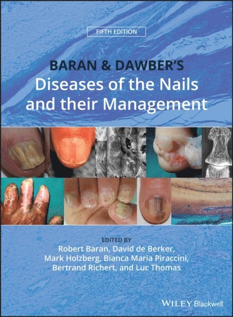 Luc Thomas, Bertrand Richert, Bianca Maria Piraccini, Mark Holzberg, David A. R. de Berker, Robert Baran - Baran and Dawber's Diseases of the Nails and their Management, E-bok