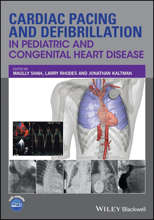 M Shah - Cardiac Pacing and Defibrillation in Pediatric and Congenital Heart Disease. Tillgänglighet: Tillfälligt slut