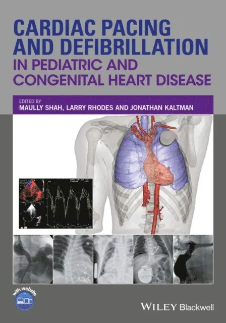 Jonathan Kaltman, Larry Rhodes, Maully Shah - Cardiac Pacing and Defibrillation in Pediatric and Congenital Heart Disease, E-bok. Tillgänglighet: Lägg i varukorg