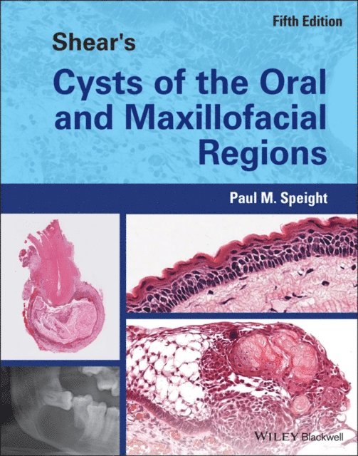 Paul M. Speight - Shear's Cysts of the Oral and Maxillofacial Regions, E-bok