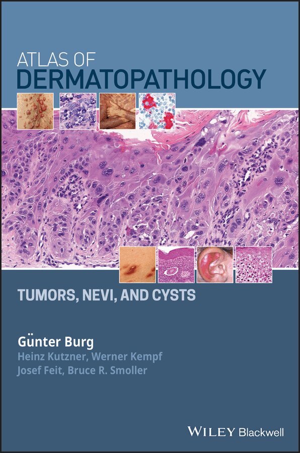 Günter Burg, Heinz Kutzner, Werner Kempf, Josef Feit, Bruce R. Smoller - Atlas of Dermatopathology Tumors and Cysts. Tillgänglighet: Tillfälligt slut