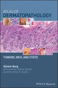 Atlas of Dermatopathology Tumors and Cysts