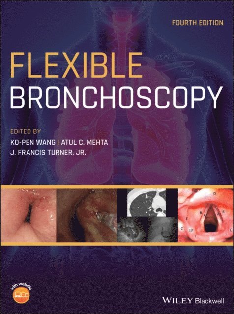 Jr. J. Francis Turner, Atul C. Mehta, Ko-Pen Wang - Flexible Bronchoscopy, E-bok