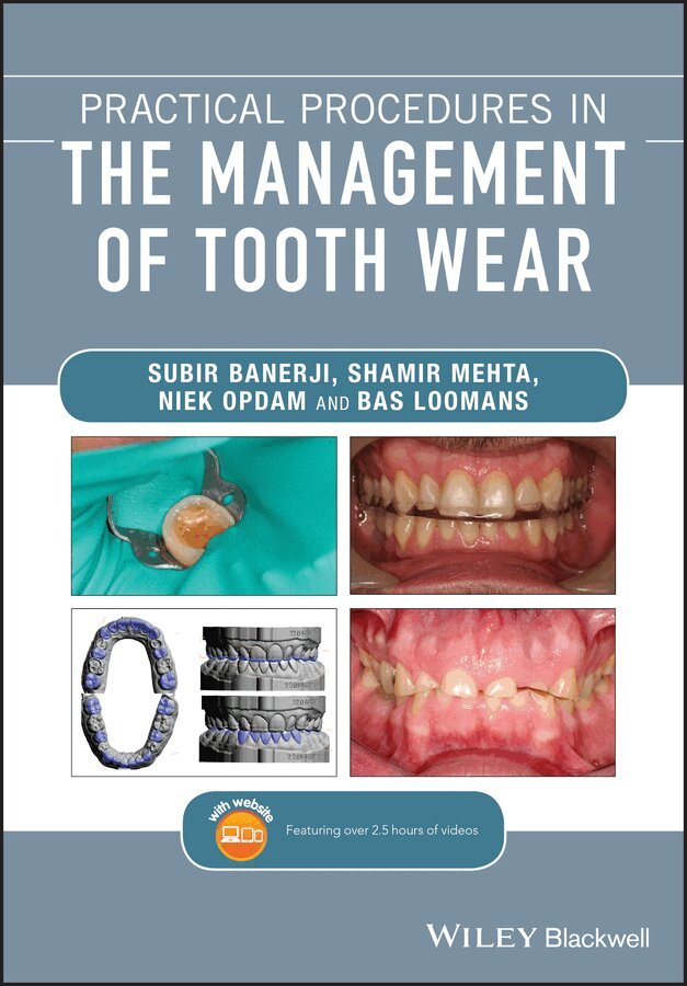 S Banerji - Practical Procedures in the Management of Tooth Wear. Tillgänglighet: Tillfälligt slut