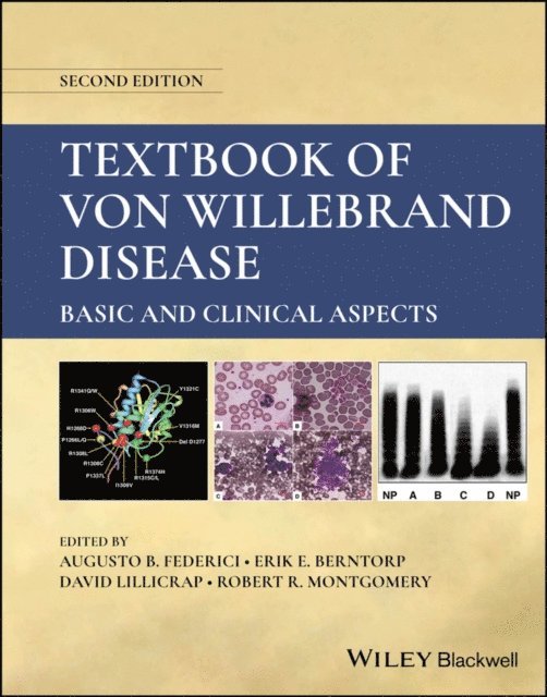 Robert R. Montgomery, David Lillicrap, Erik E. Berntorp, Augusto B. Federici - Textbook of Von Willebrand Disease, E-bok