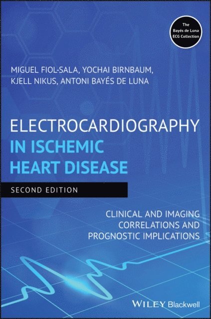 Antoni Bay s de Luna, Kjell Nikus, Yochai Birnbaum, Miquel Fiol-Sala - Electrocardiography in Ischemic Heart Disease, E-bok