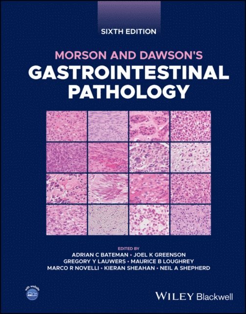 Neil A. Shepherd, Kieran Sheahan, Marco R. Novelli, Maurice B. Loughrey, Gregory Y. Lauwers, Joel K. Greenson, Adrian C. Bateman - Morson and Dawson's Gastrointestinal Pathology, E-bok