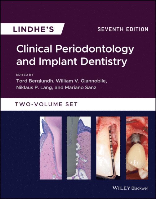 Mariano Sanz, William V. Giannobile, Tord Berglundh, Niklaus P. Lang - Lindhe's Clinical Periodontology and Implant Dentistry, E-bok