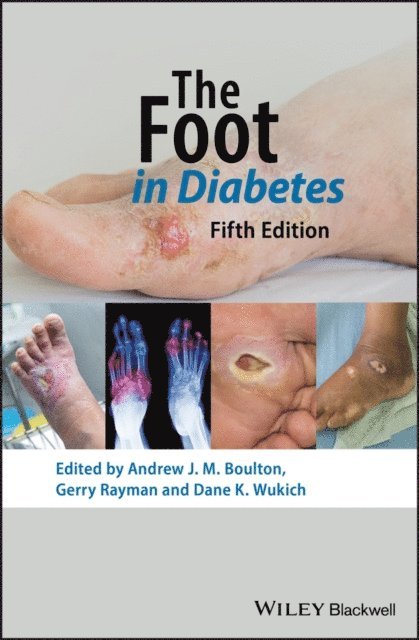 Dane K. Wukich, Gerry Rayman, Andrew J. M. Boulton - Foot in Diabetes, E-bok