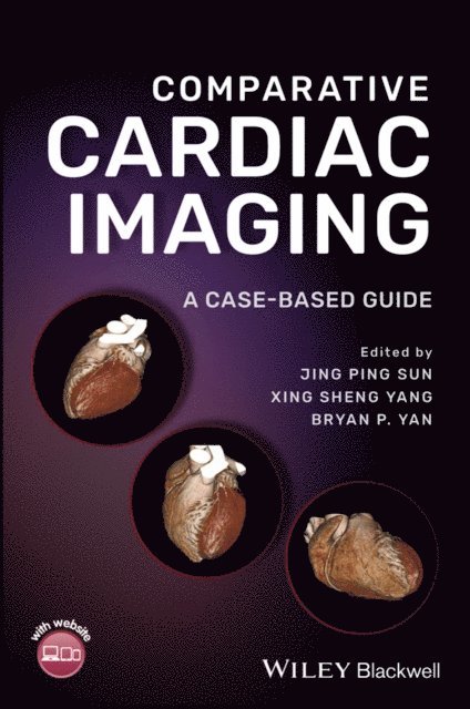 Bryan P. Yan, Xing Sheng Yang, Jing Ping Sun - Comparative Cardiac Imaging, E-bok