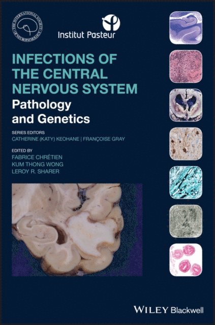 Leroy R. Sharer, Kum Thong Wong, Fabrice Chretien - Infections of the Central Nervous System, E-bok