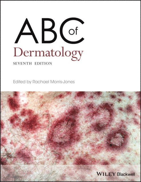 Rachael Morris-Jones - ABC of Dermatology, E-bok