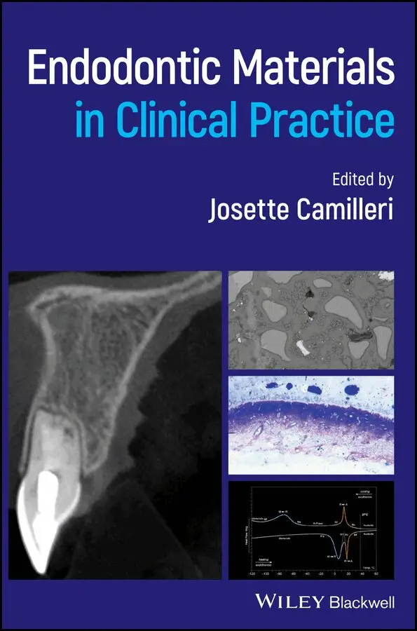 J Camilleri - Endodontic Materials in Clinical Practice. Tillgänglighet: Tillfälligt slut