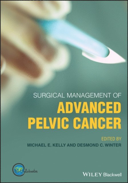 Michael E. Kelly, Desmond C. Winter - Surgical Management of Advanced Pelvic Cancer, E-bok