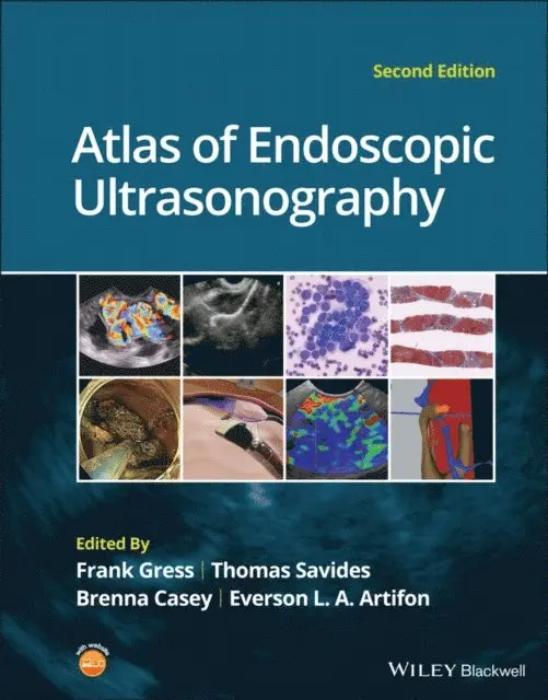 Everson L. A. Artifon, Brenna Casey, Thomas J. Savides, Frank G. Gress - Atlas of Endoscopic Ultrasonography, E-bok. Tillgänglighet: Lägg i varukorg