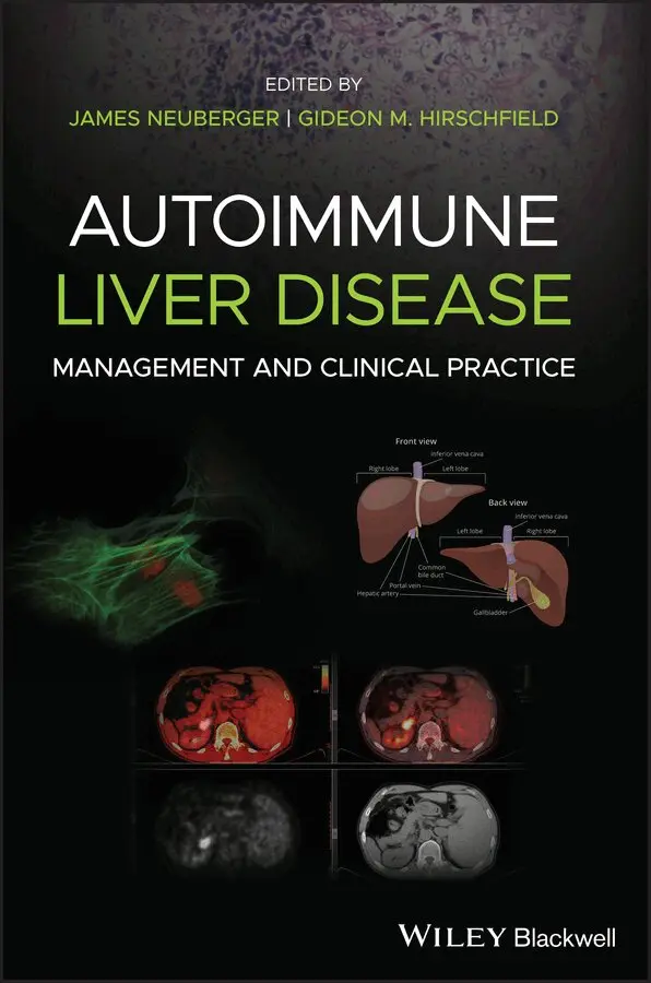 James Neuberger, Gideon M. Hirschfield - Autoimmune Liver Disease – Management and Clinical Practice. Tillgänglighet: Tillfälligt slut