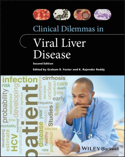 K. Rajender Reddy, Graham R. Foster - Clinical Dilemmas in Viral Liver Disease, E-bok