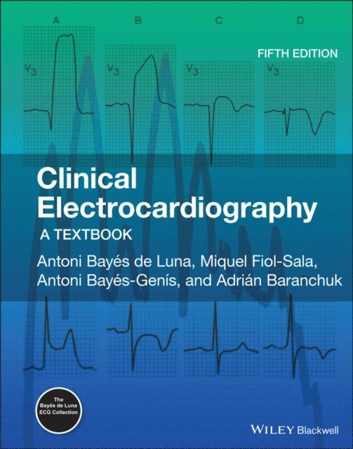 Adrian Baranchuk, Antoni Bay s-Gen s, Miquel Fiol-Sala, Antoni Bay s de Luna - Clinical Electrocardiography, E-bok