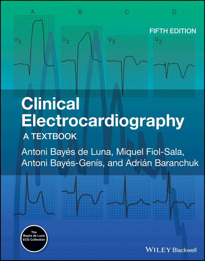 Antoni Bayés de Luna, Miquel Fiol-Sala, Antoni Bayés-Genís, Adrian Baranchuk - Clinical Electrocardiography – A Textbook 5e. Tillgänglighet: Tillfälligt slut