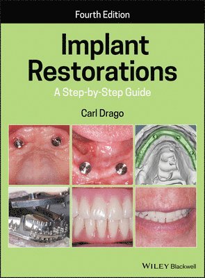 Carl Drago - Implant Restorations, Inbunden. Tillgänglighet: Tillfälligt slut