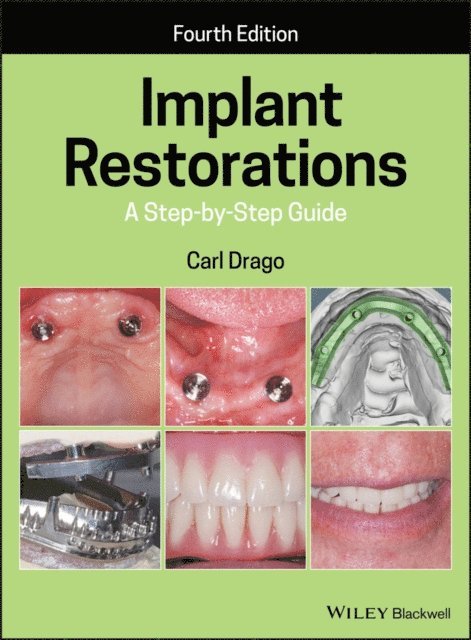 Carl Drago - Implant Restorations, E-bok