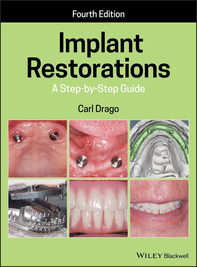 Carl Drago - Implant Restorations – A Step–by–Step Guide. Tillgänglighet: Tillfälligt slut