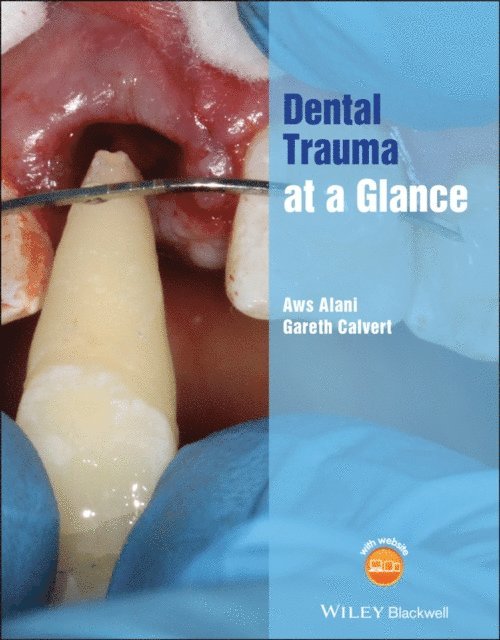 Gareth Calvert, Aws Alani - Dental Trauma at a Glance, E-bok