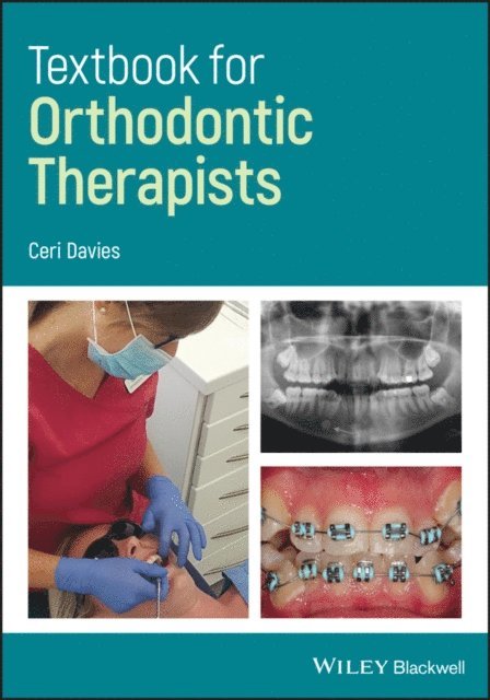 Ceri Davies - Textbook for Orthodontic Therapists, E-bok