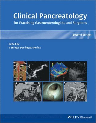 Juan Enrique Dominguez-Munoz - Clinical Pancreatology for Practising Gastroenterologists and Surgeons, Inbunden